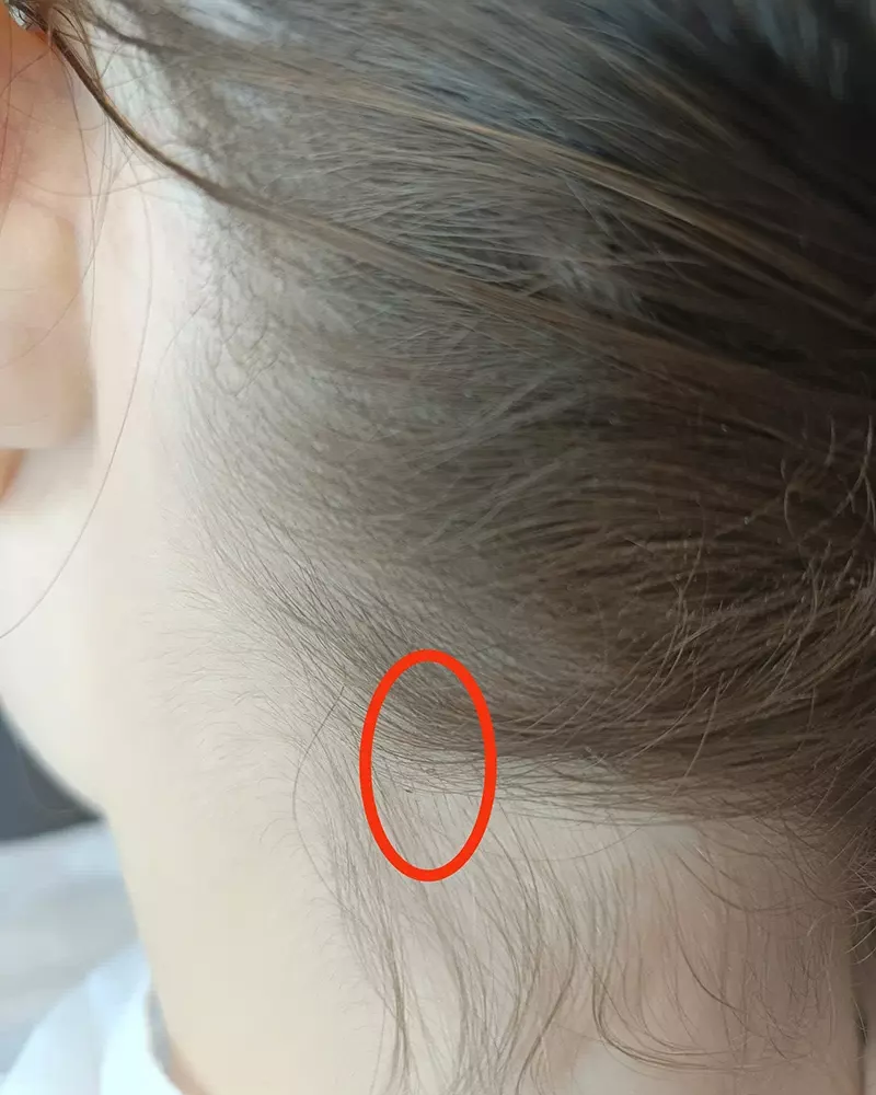 Traitement anti-poux dans le centre À Pas de Poux à La Roche-sur-Yon