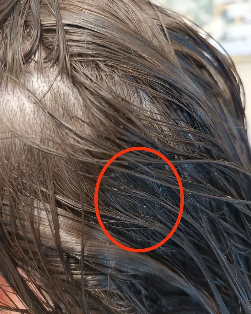 Traitement anti-poux dans le centre À Pas de Poux à La Roche-sur-Yon