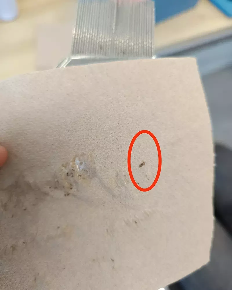 Traitement anti-poux dans le centre À Pas de Poux à La Roche-sur-Yon