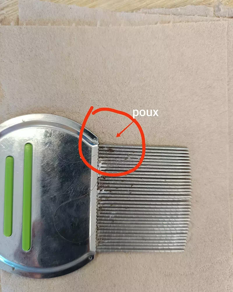Traitement anti-poux dans le centre À Pas de Poux à La Roche-sur-Yon